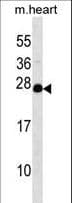 Polyclonal Rabbit anti-Human NUDT4 Antibody (aa1-30, WB)