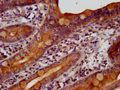 TKFC / DAK Antibody