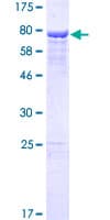 Human SAMD11 Protein (Recombinant GST)