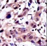 Polyclonal Rabbit anti-Human MUSK Antibody (aa35-65, IHC, WB)