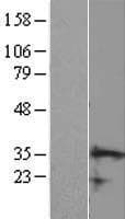 CCDC106 Protein (Over-Expression Lysate Myc-DDK (Flag))