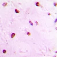 NF45 / ILF2 Antibody