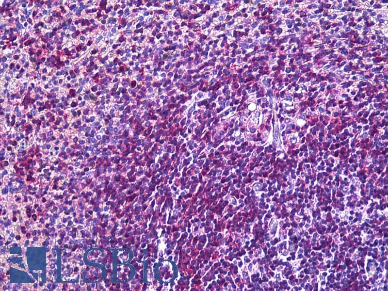 IHC-plus™ ITGAL / CD11a Antibody (aa953-965)
