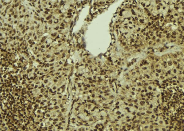 PRPF31 Antibody