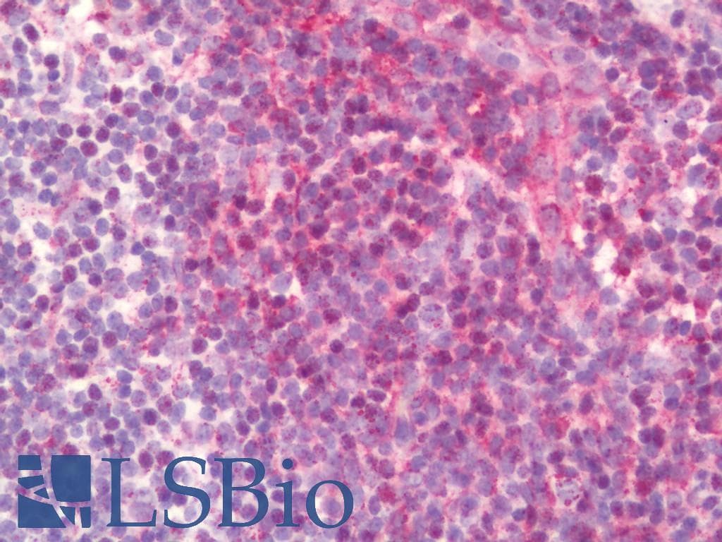 IHC-plus™ CEP44 / KIAA1712 Antibody (aa278-307)
