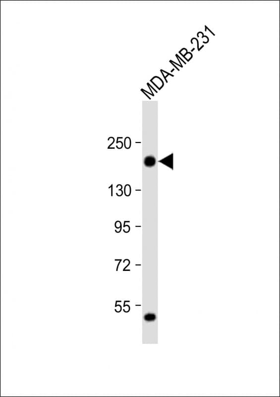 THBS1 / Thrombospondin-1 Antibody (C-Terminus)