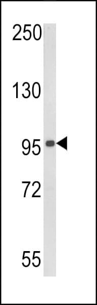 DDX58 / RIG-1 / RIG-I Antibody (aa585-614)