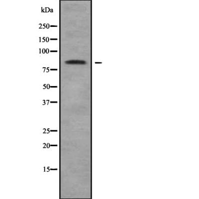 Polyclonal Rabbit anti-Human CLLP / CTNNAL1 Antibody (IHC, WB)