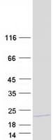 Human MRPL32 Protein (Recombinant Myc-DDK (Flag))