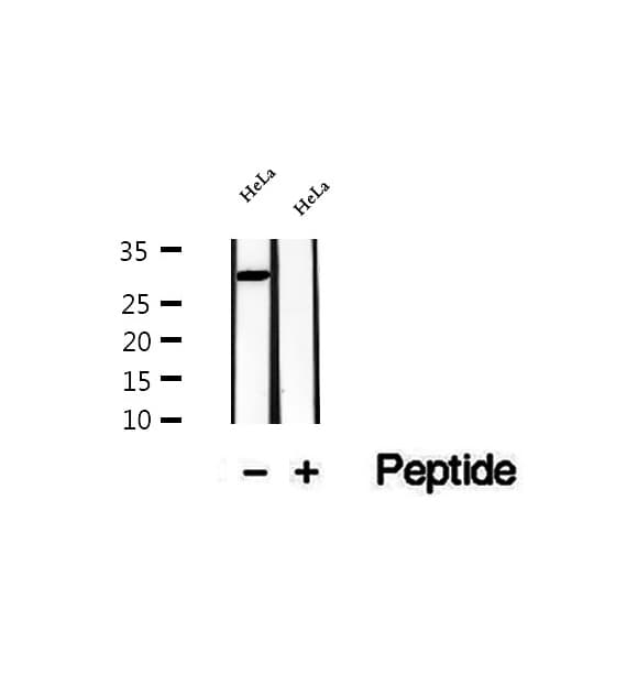 NAR / CPSF4 Antibody