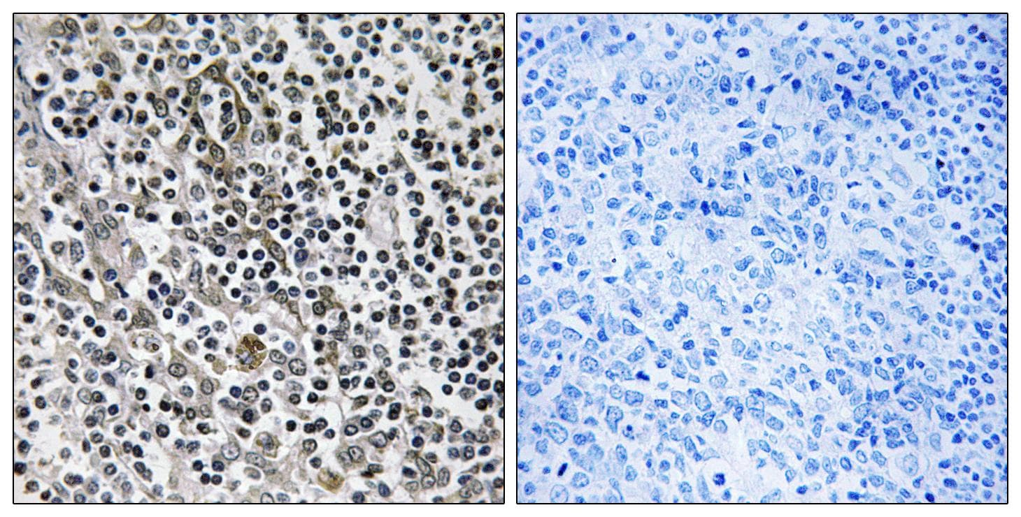 Polyclonal Rabbit anti-Human MRPL51 Antibody (IHC, WB)