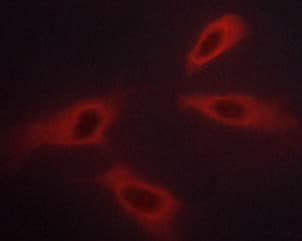 Polyclonal Rabbit anti-Human ABL1 / c-ABL Antibody (phospho-Tyr245, IF, WB)