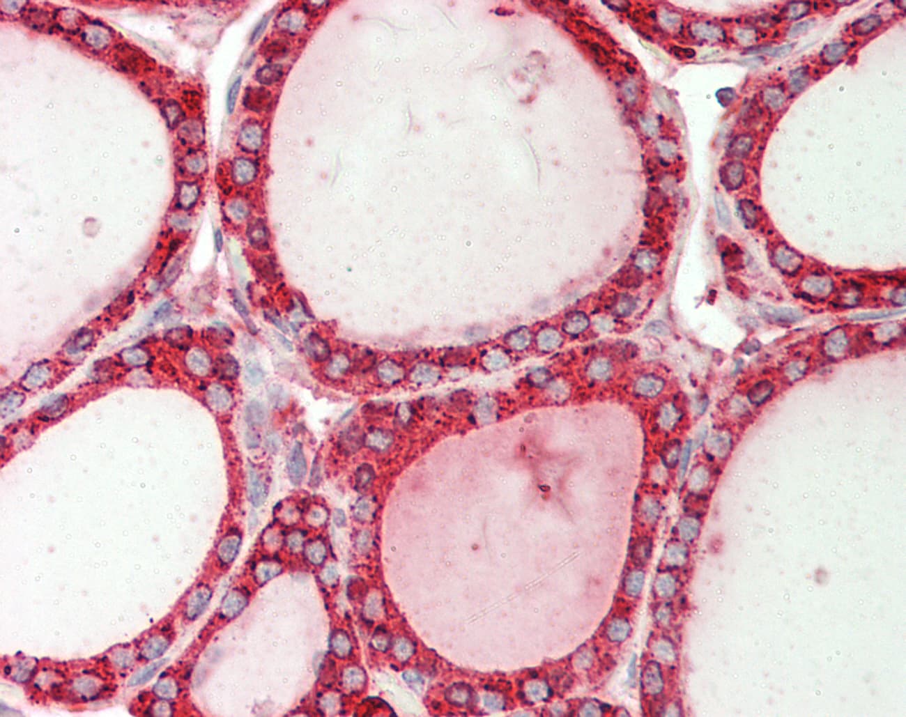 HSP90B1 / GP96 / GRP94 Antibody (C-Terminus)