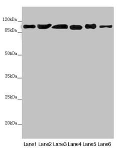 DHTKD1 Antibody