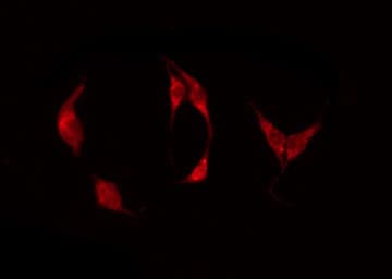 ADGRE1 / EMR1 Antibody (aa826-876)