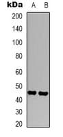 Monoclonal Mouse anti-Human FCGR3A / CD16A Antibody (IHC, WB)