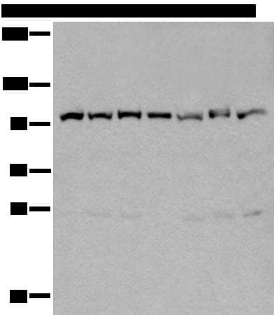 VCP Antibody