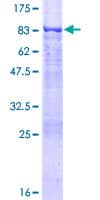 Human RPS6KL1 Protein (Recombinant GST)
