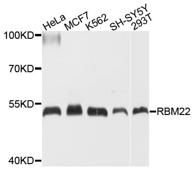 Polyclonal Rabbit anti-Human RBM22 Antibody (WB)