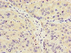 Polyclonal Rabbit anti-Human COT / CROT Antibody (aa1-87, IHC, WB)