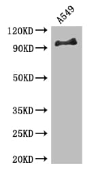 FGFR1 / FGF Receptor 1 Antibody