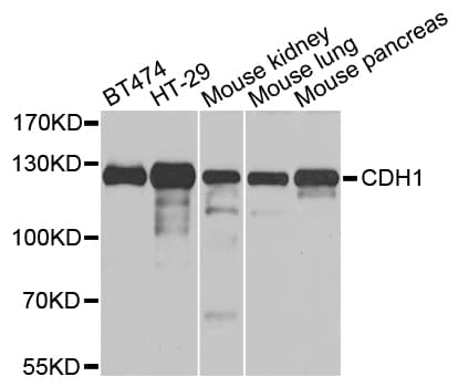 CDH1 / E Cadherin Antibody