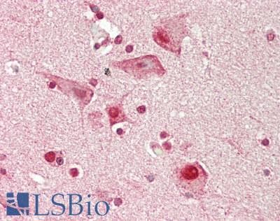 IHC-plus™ SNRPD3 Antibody (aa9-38)