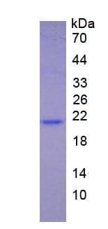Human IFNA5 / Interferon Alpha 5 Protein (Recombinant)