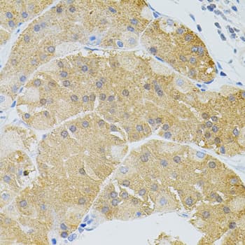 Polyclonal Rabbit anti-Human SYK Antibody (IHC, WB)
