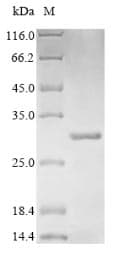 E. coli Beta-Lactamase CTX-M-1 Protein (Recombinant 6His, C-terminus)