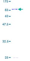 Human P5CDH / ALDH4A1 Protein (Recombinant GST)