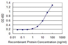 Monoclonal Mouse anti-Human EMA / MUC1 Antibody (clone 1B7, WB)