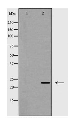 RAB5A / RAB5 Antibody