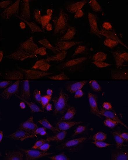 GPER1 / GPR30 Antibody