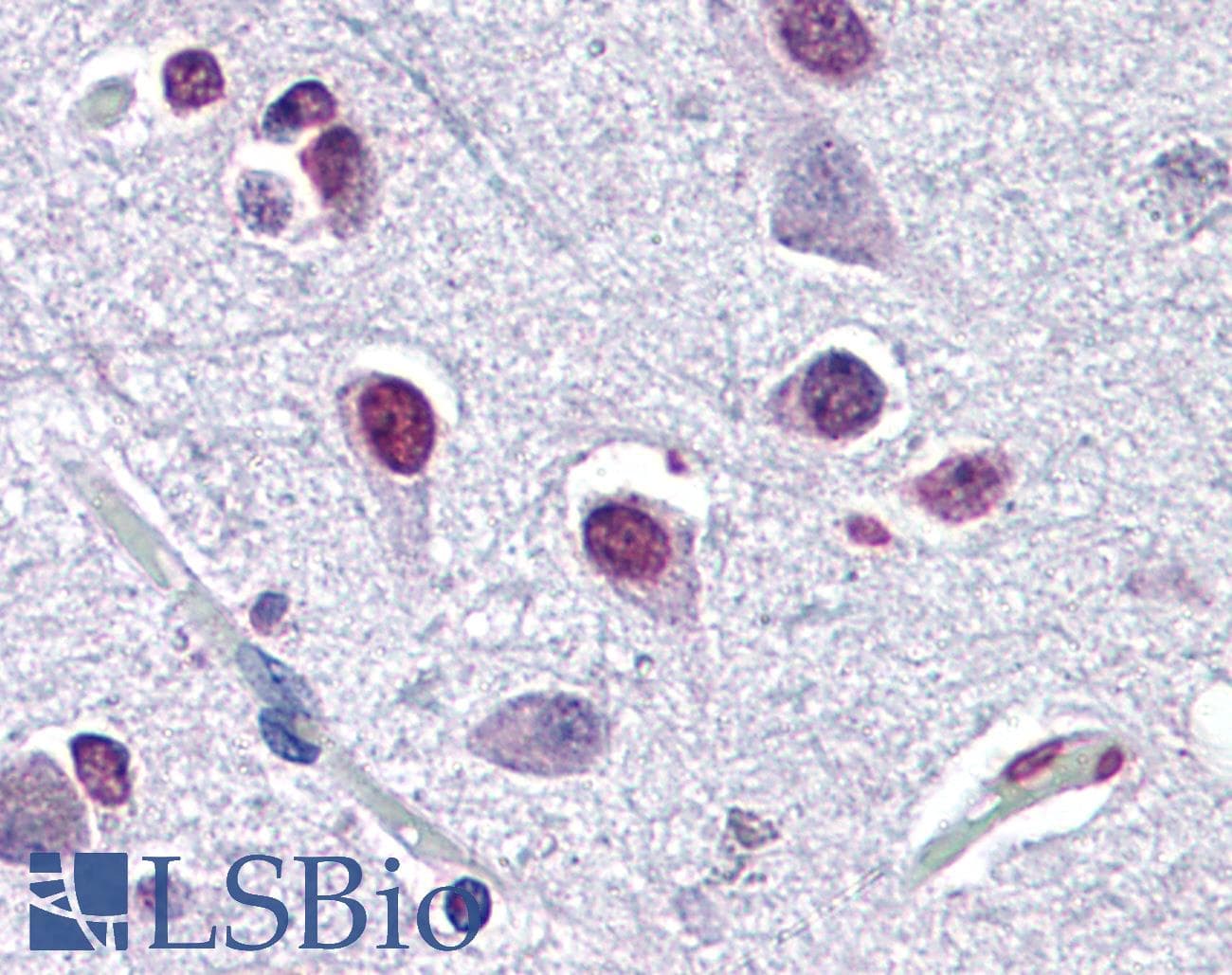 IHC-plus™ ATF2 Antibody (clone 4A3)
