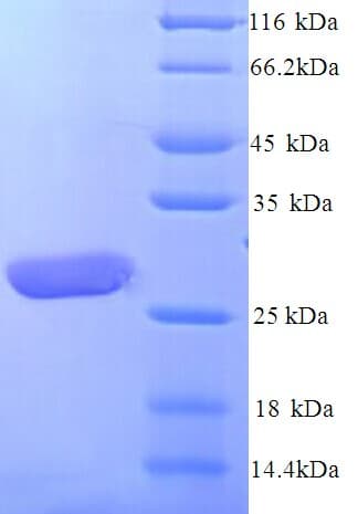 Human LILRA5 Protein (Recombinant His)