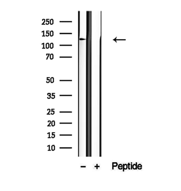 Polyclonal Rabbit anti-Human NCKAP1 / NAP125 Antibody (IHC, WB)