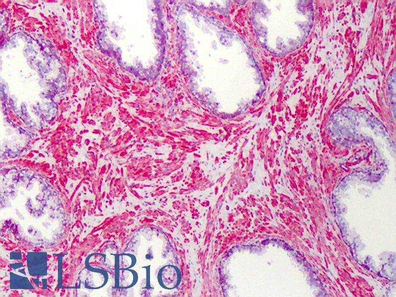 IHC-plus™ SLC5A3 Antibody (aa221-270)