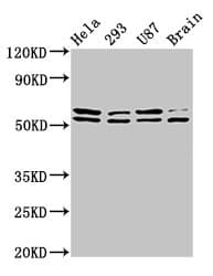 Polyclonal Rabbit anti-Human CD3EAP Antibody (IHC, IF, WB)