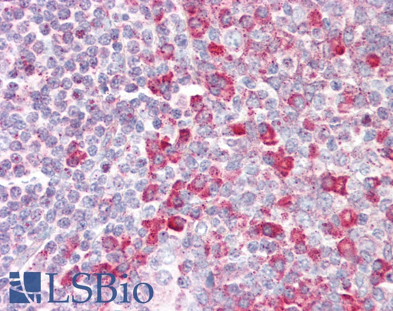 IHC-plus™ Polyclonal Rabbit anti-Human RNGTT / HCAP Antibody (IHC, WB)