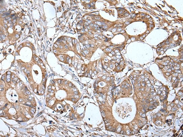 APOD / Apolipoprotein D Antibody