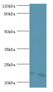 ATP5O Antibody (aa24-213)