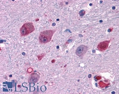 PathPlus™ P2RY14 / GPR105 Antibody (Extracellular Domain)