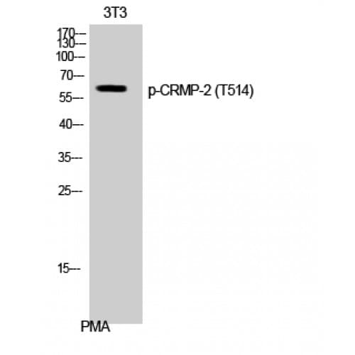Polyclonal Rabbit anti-Human DPYSL2 / CRMP2 Antibody (450-530 aa, IHC, IF, WB)