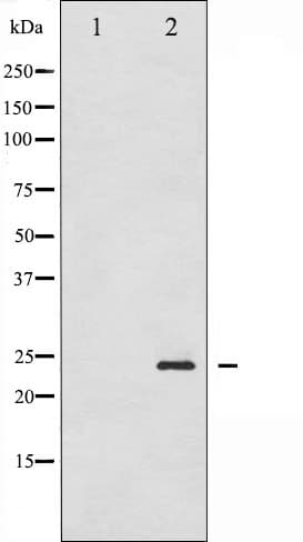 CAV1 / Caveolin 1 Antibody (phospho-Tyr14)