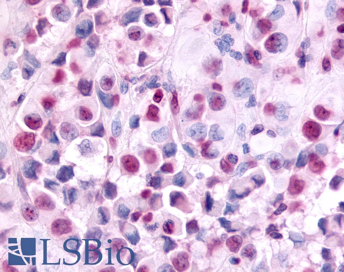 IHC-plus™ Polyclonal Rabbit anti-Human EAR2 / NR2F6 Antibody (Ligand-binding Domain, IHC)
