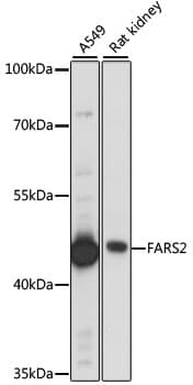 Polyclonal Rabbit anti-Human FARS2 Antibody (WB)