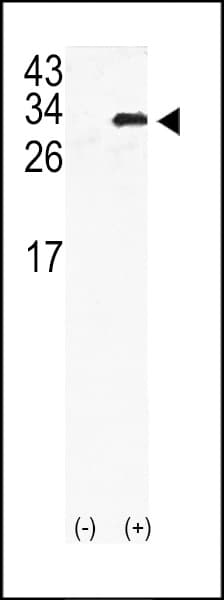 GJB6 / CX30 / Connexin 30 Antibody (aa87-117)