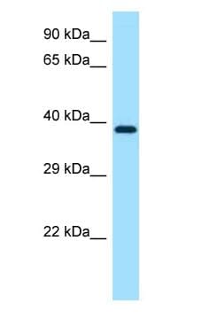 MAP2K1 / MKK1 / MEK1 Antibody (C-Terminus)