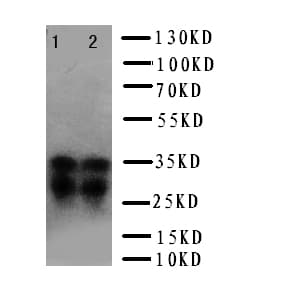 PRNP / PrP / Prion Antibody (aa143-159)
